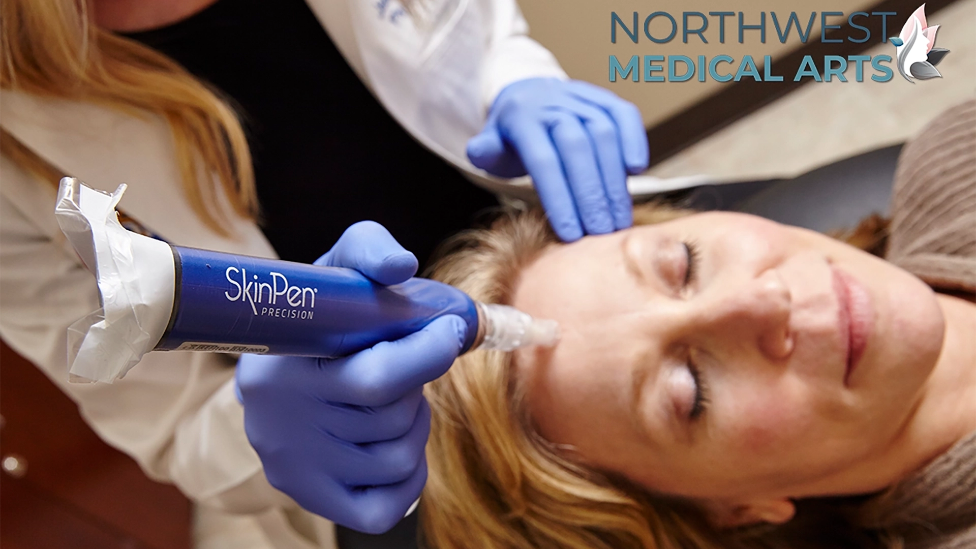 Microneedling, PRP, PRFM Treatments