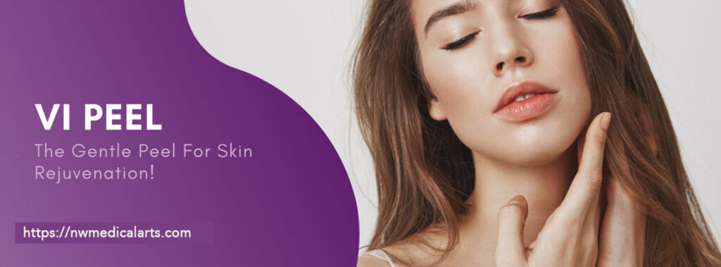 VI Peel, Medical-grade chemical peel, safe for all skin types, and designed to tackle aging, acne, and hyper pigmentation. 
