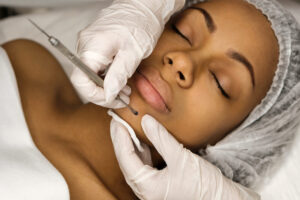 Medical Facial, Dermaplane, Extractions, Chemical Peel