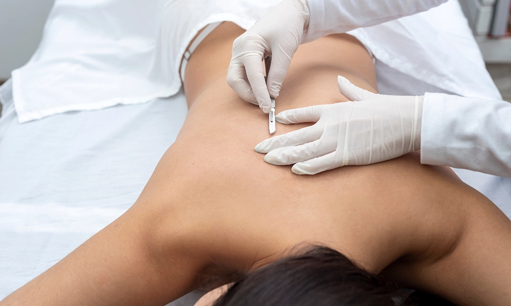 Back Facial to clear up blemishes on the back, or Bacne